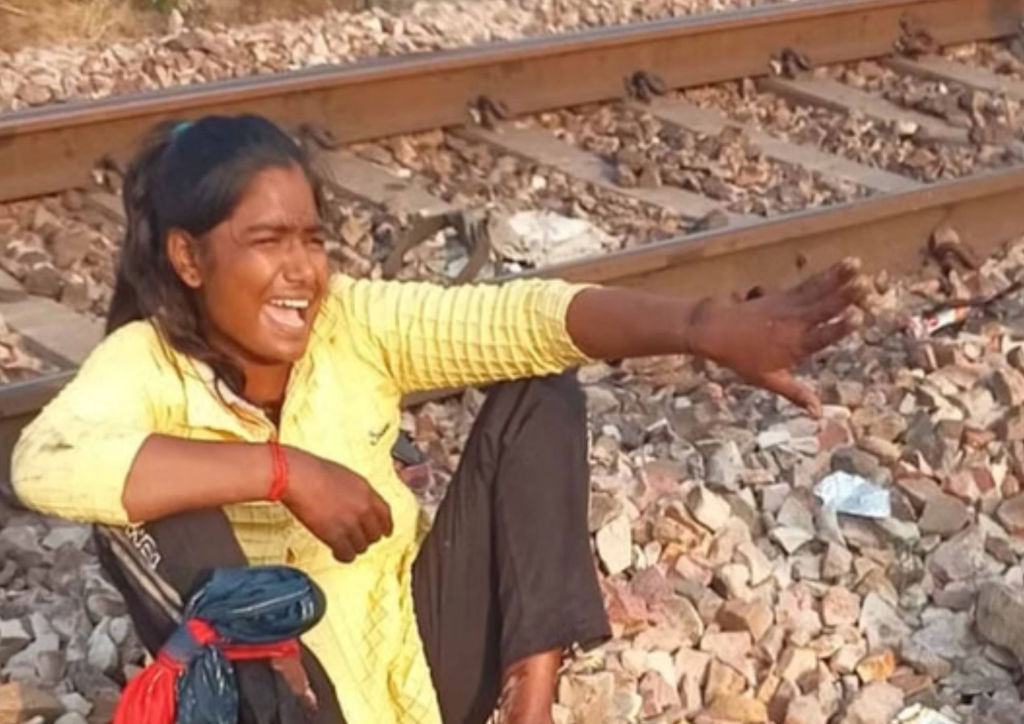 UP: ट्रेन से कटे पैर... दर्द में भी छात्रा को याद आए पिता; दिल दहला देने वाली तस्वीर